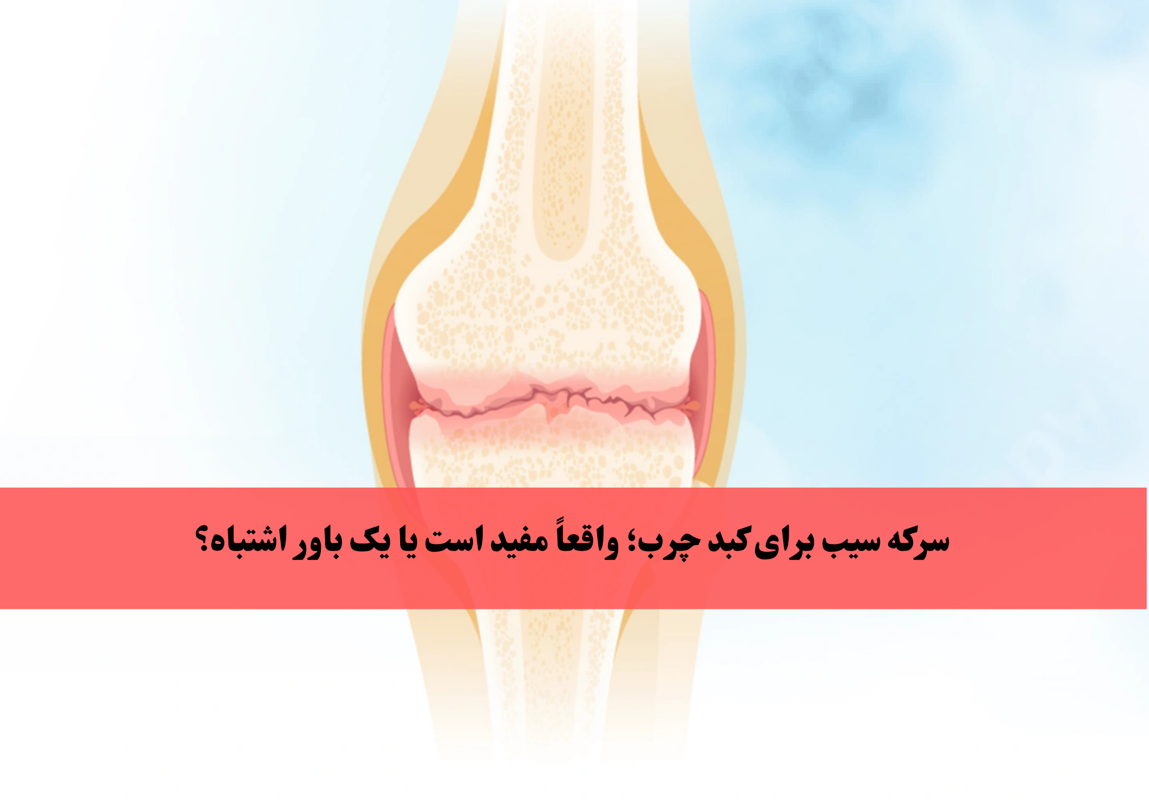بهترین قرص برای زانو درد کدام است؟ راهنمای کامل درمان دارویی آرتروز و ساییدگی زانو